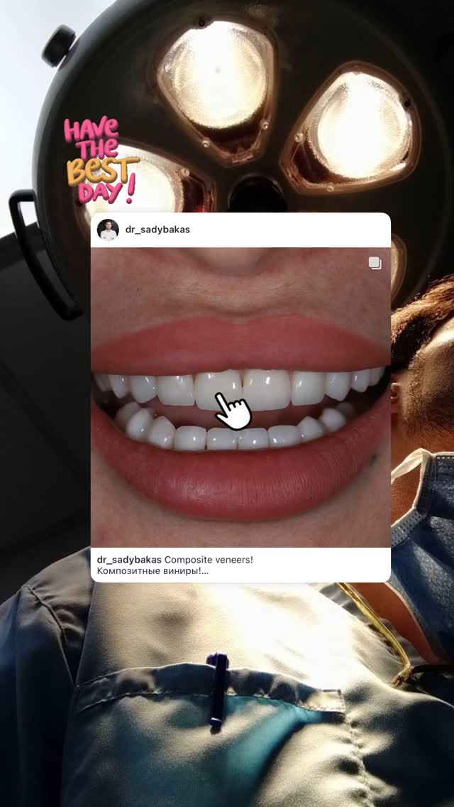 Керамические виниры