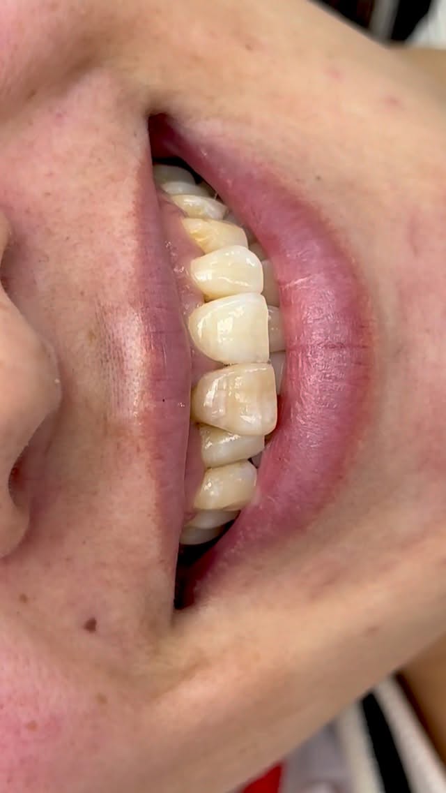 Консультация стоматолога