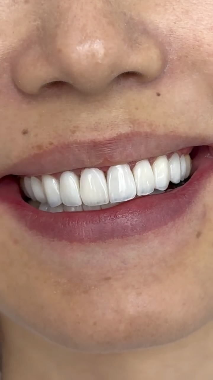 Художественная реставрация